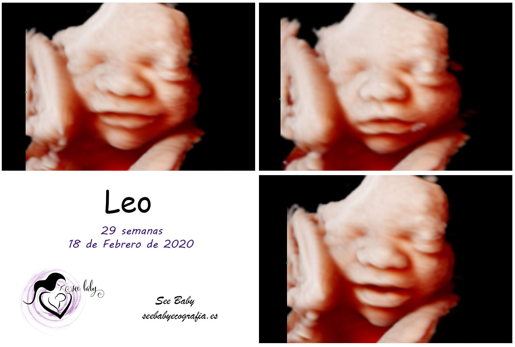 Leo en SeeBaby Ecografia 5D