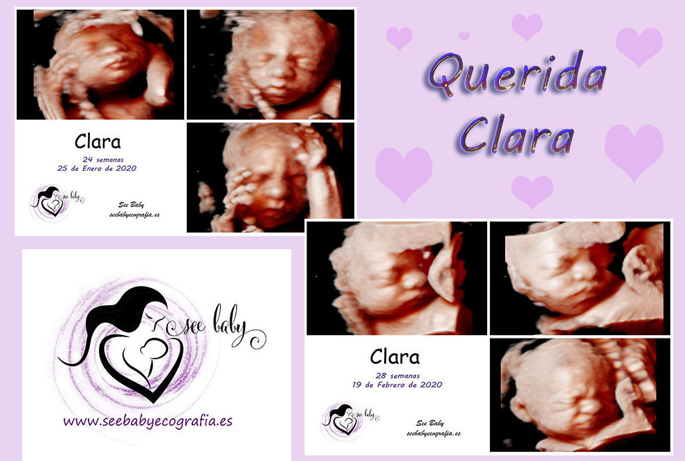 Querida Clara en SeeBaby Ecografia 5D