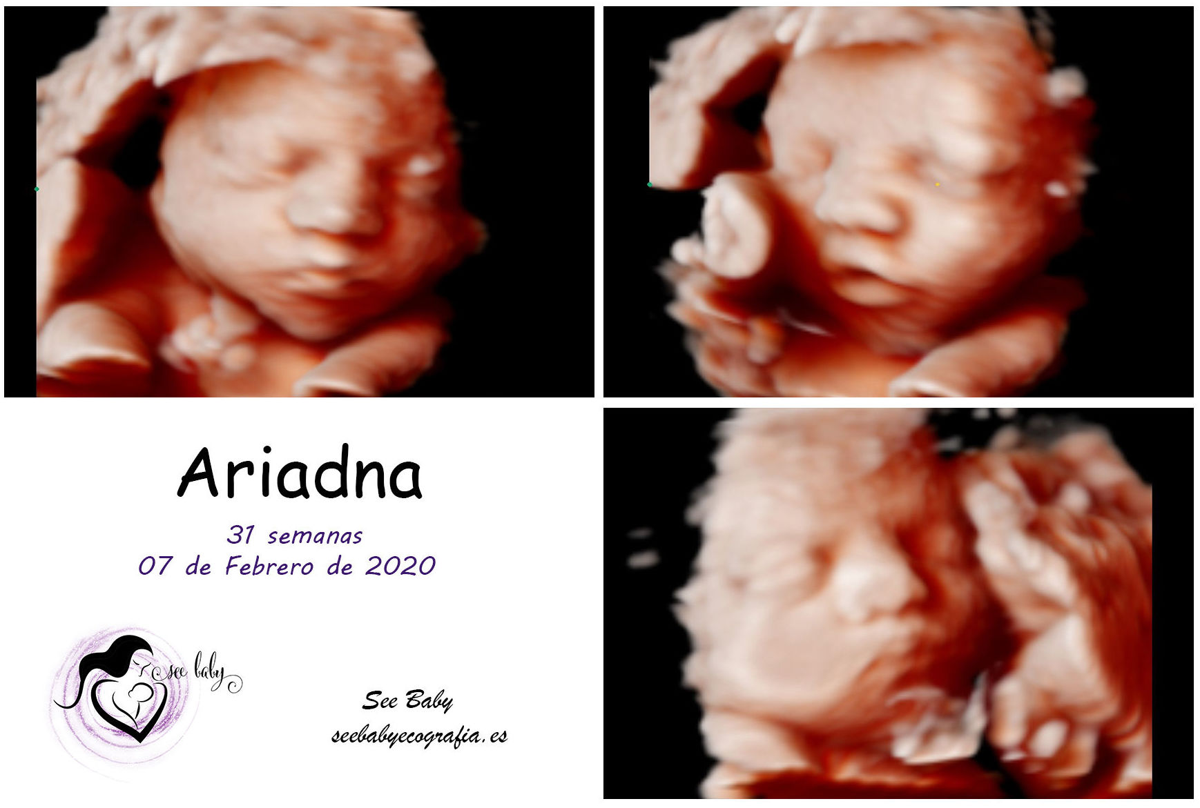 Querida Ariadna - Seebaby Ecografia 5D