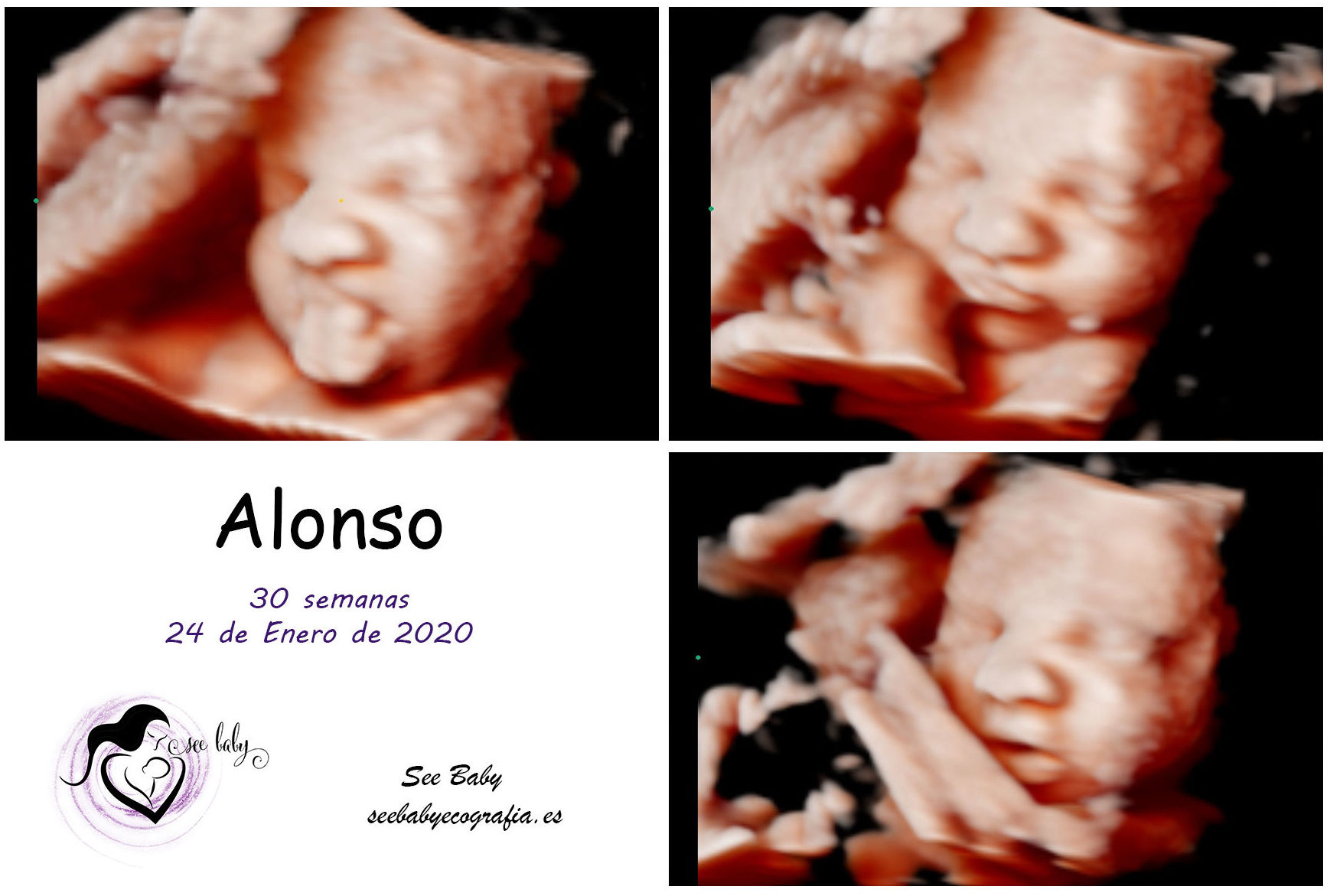 Querido Alonso en SeeBaby Ecografia 5D