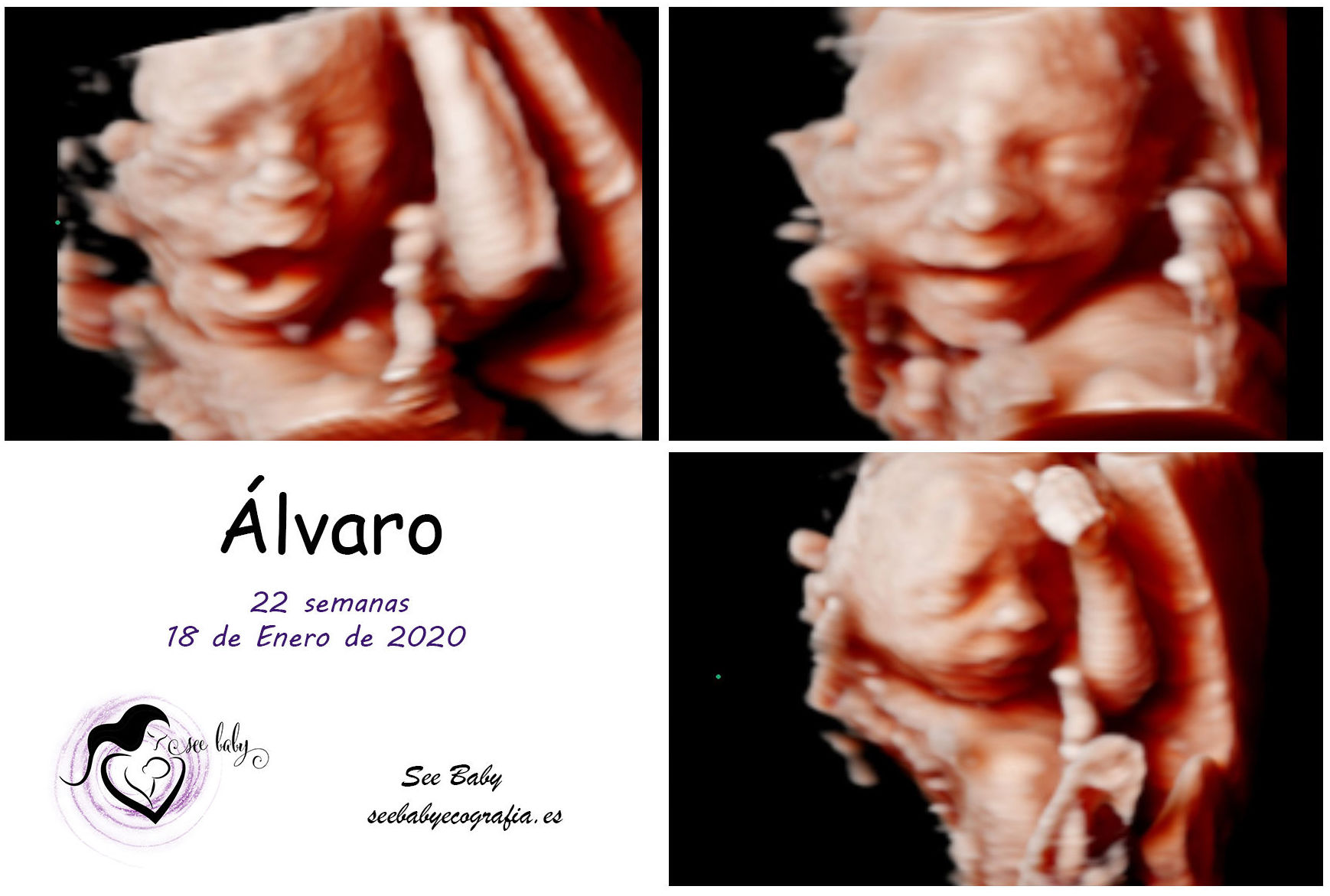 Querido Álvaro en SeeBaby Ecografia 5D