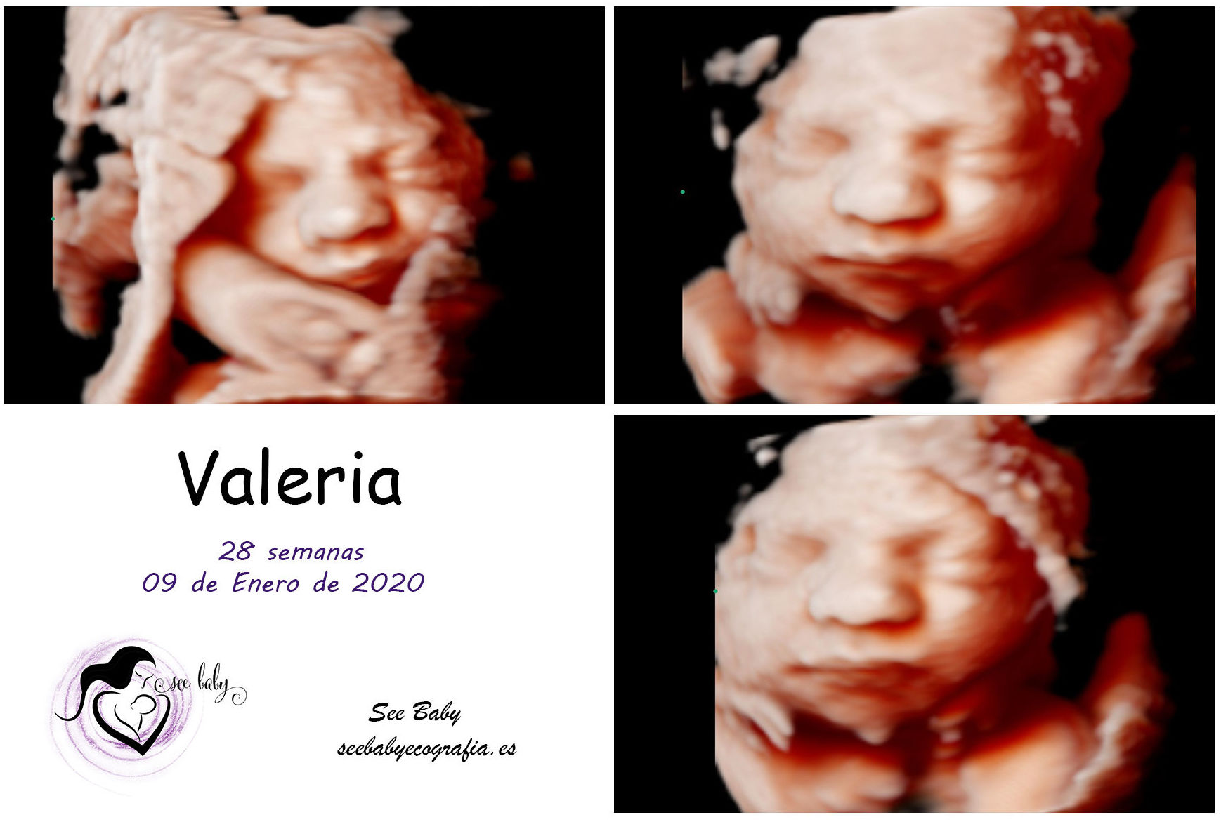 Querida Valeria en SeeBaby Ecografia 5D