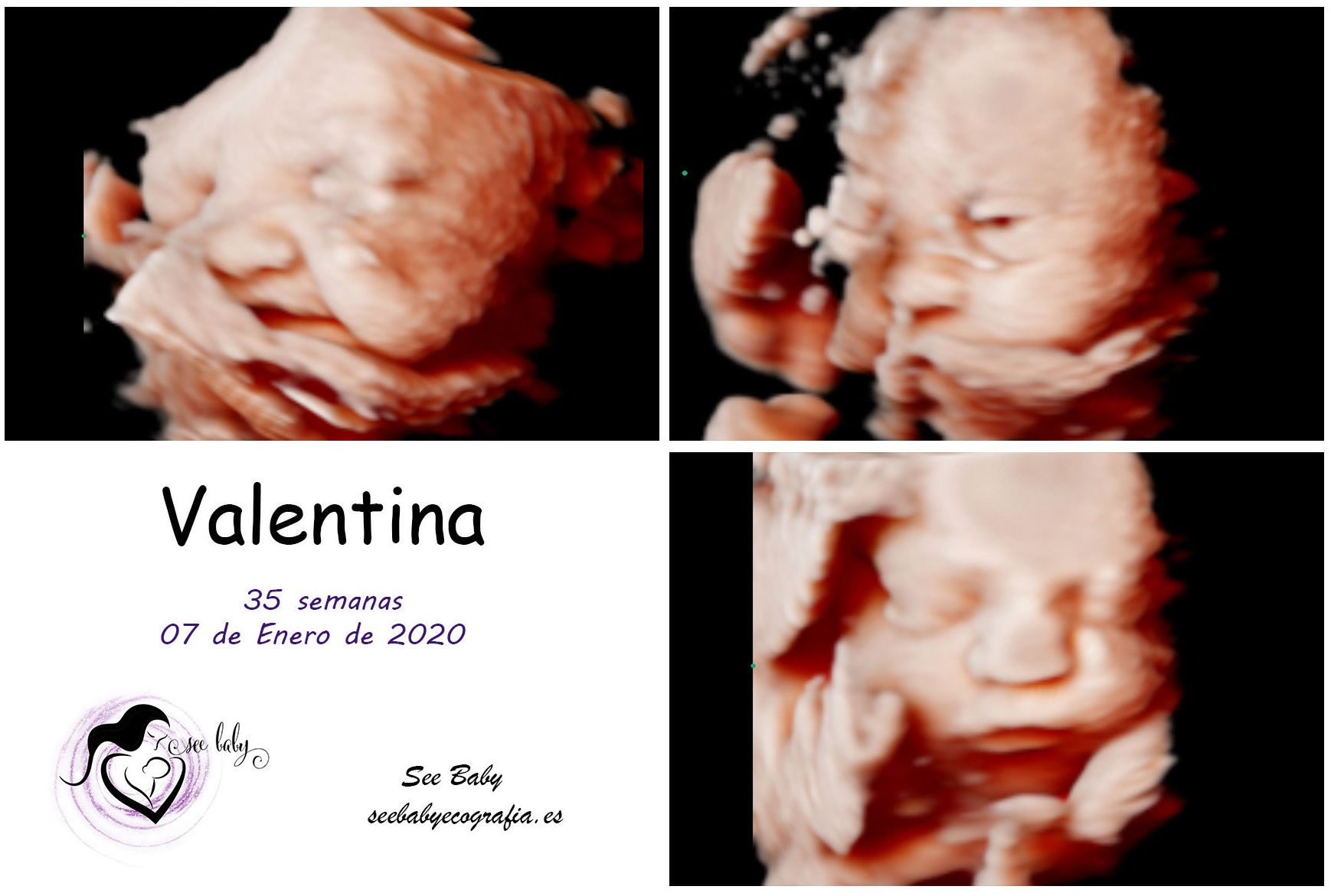 Querida Valentina - SeeBaby Ecografia 5D