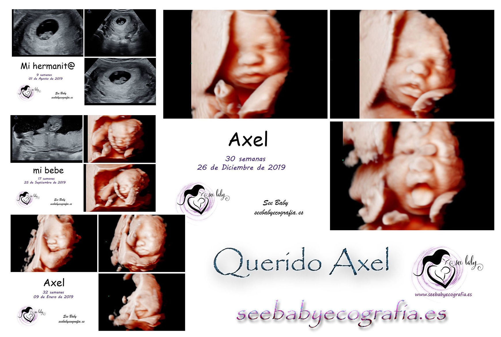 Nuestro querido Axel en SeeBaby Ecografia 5D