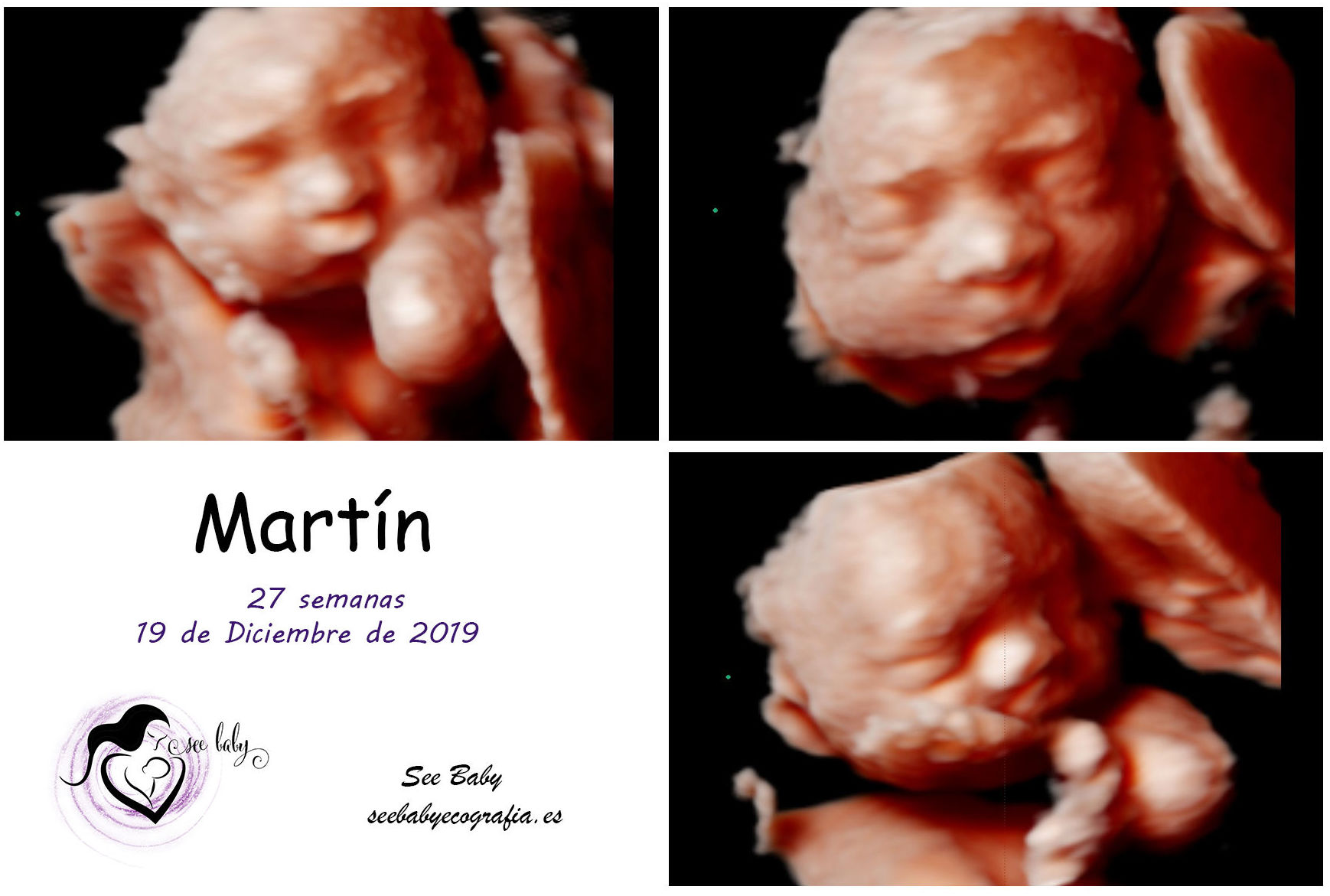 Bienvenido Martin en SeeBaby Ecografia 5D