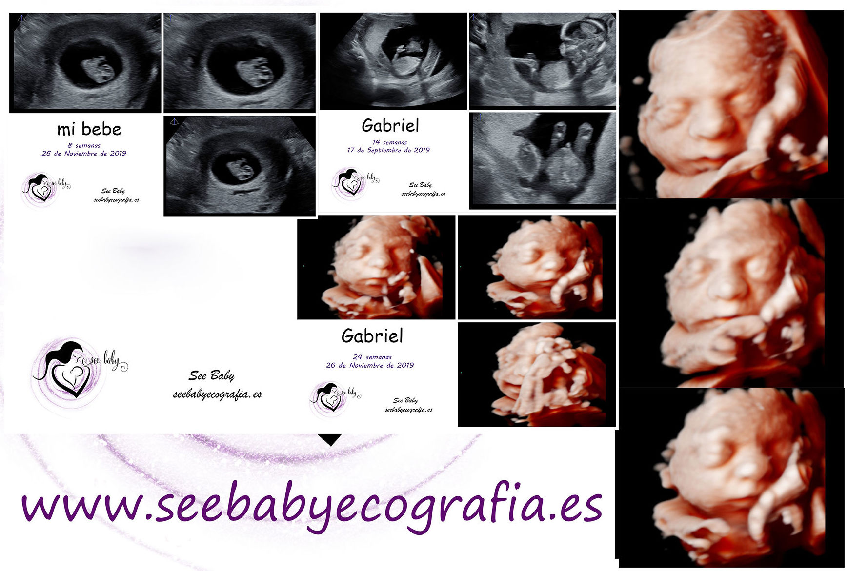 Tan querido Gabriel en SeeBaby Ecografia 5D