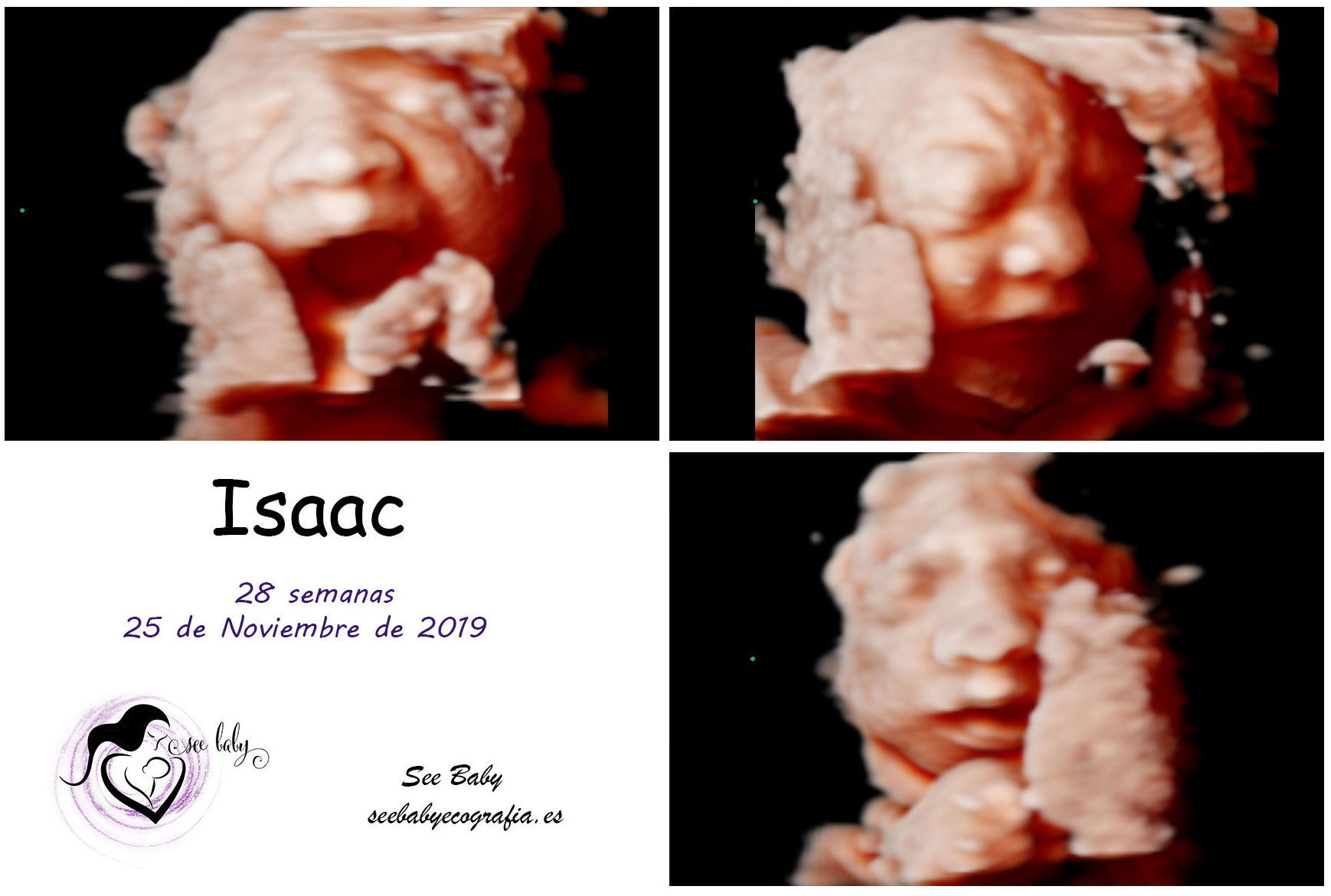 Querido Isaac - SeeBaby Ecografia 5D