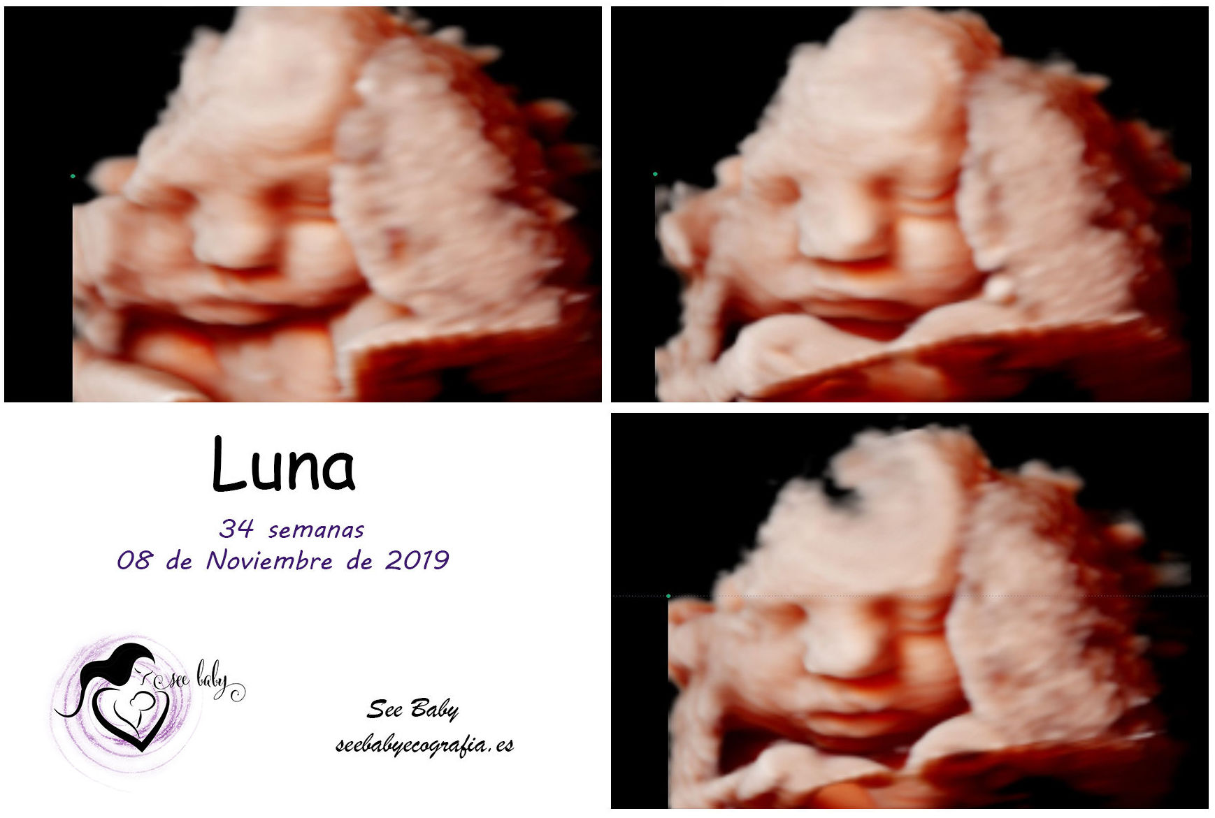 Bienvenida Luna - SeeBaby Ecografia 5D