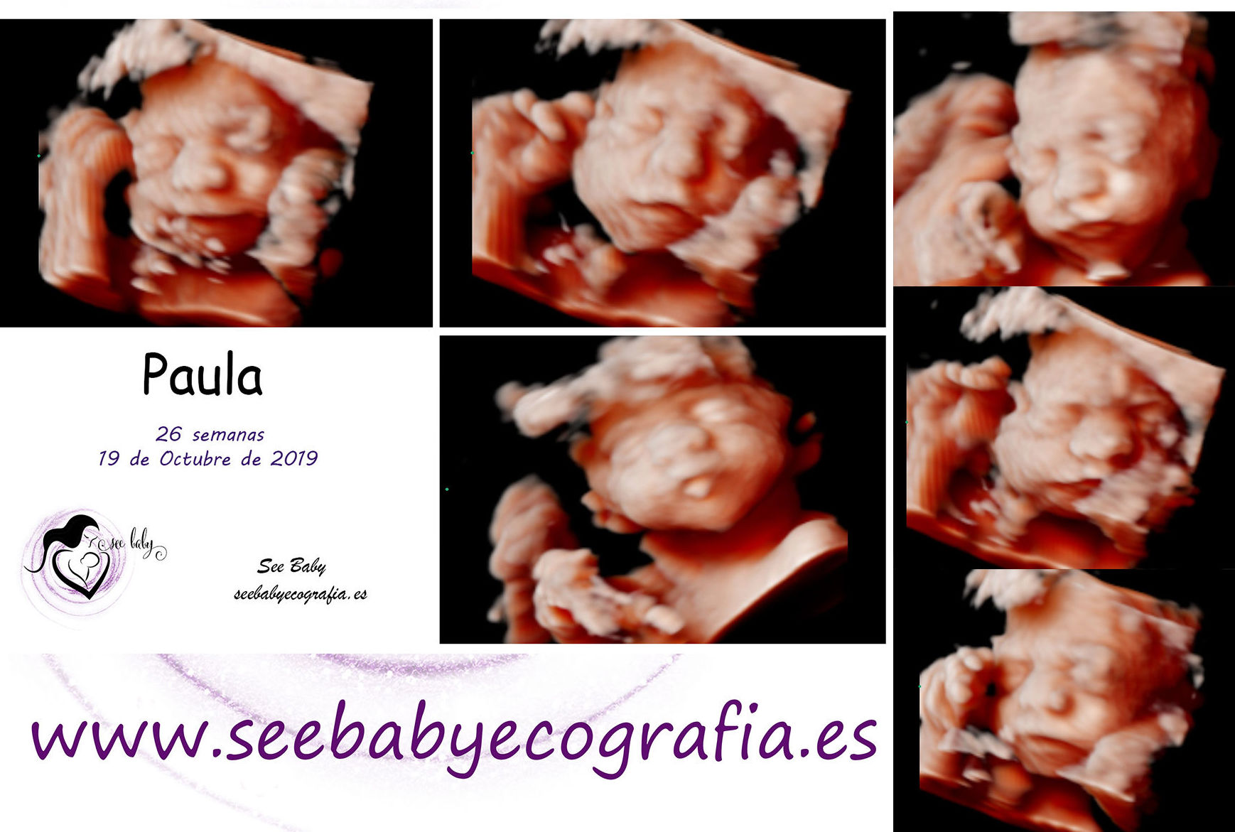 Querida Paula - SeeBaby Ecografia 5D