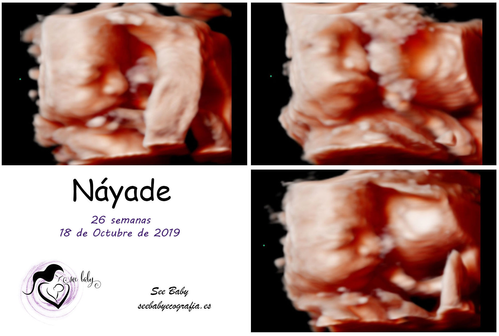 Os presentamos a Náyade en SeeBaby Ecografia 5D