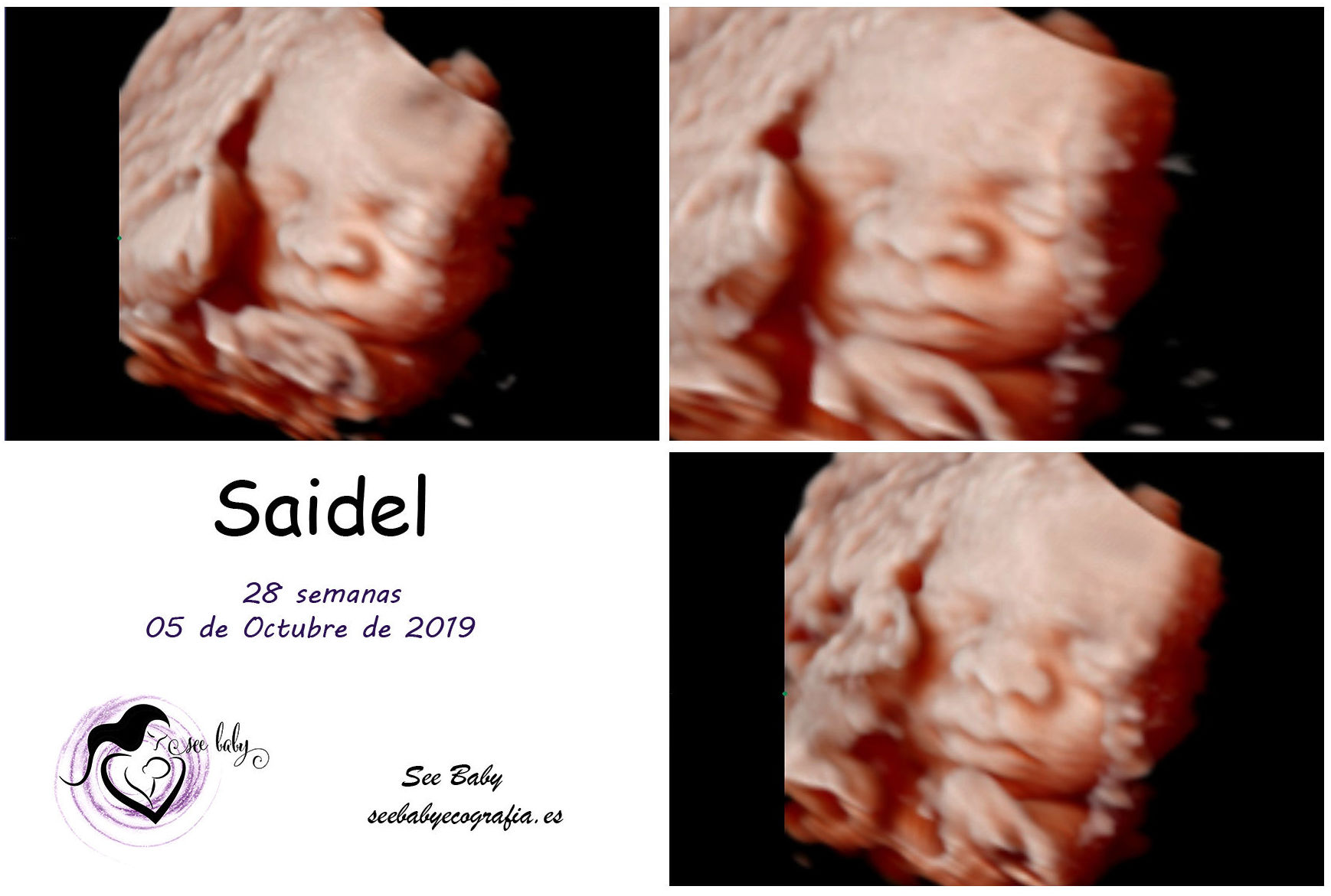 Os presentamos a Saidel en SeeBaby Ecografia 5D