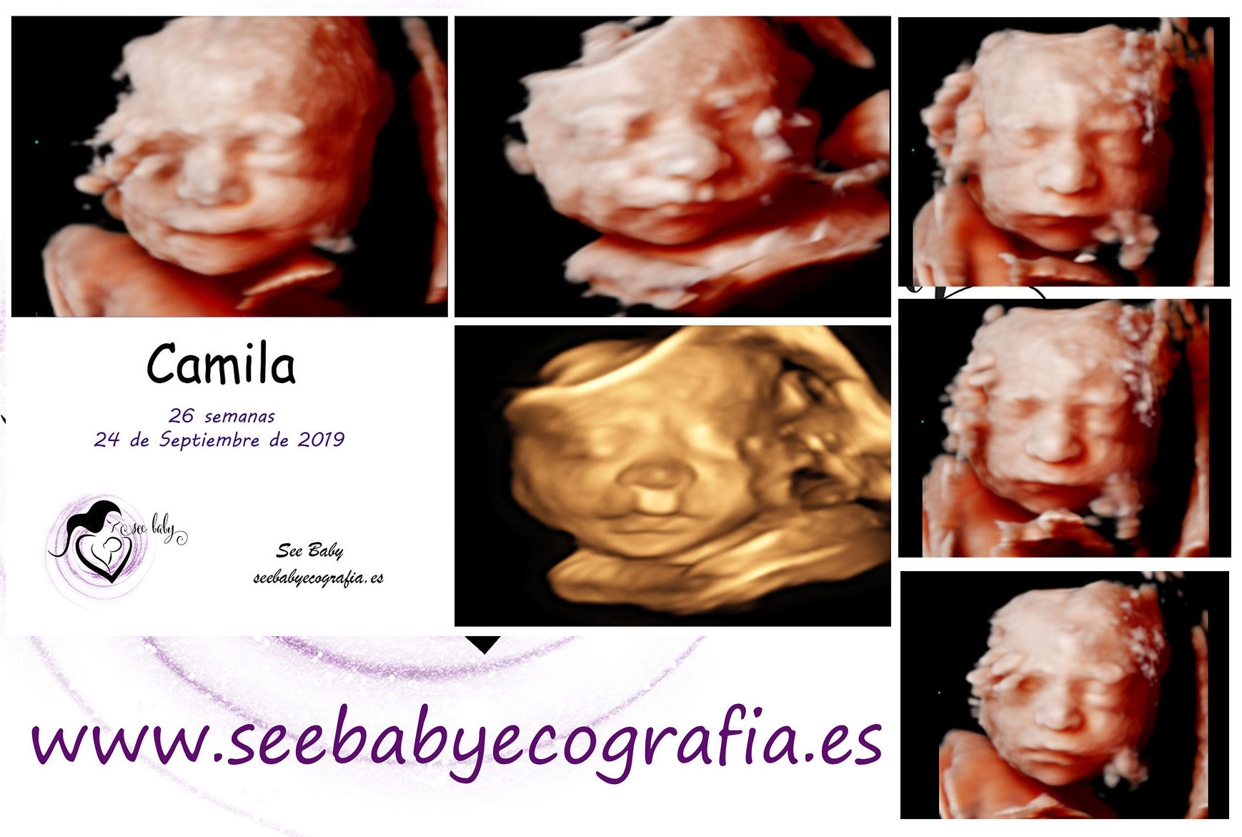 Dulce Camila en SeeBaby ecografia 5D