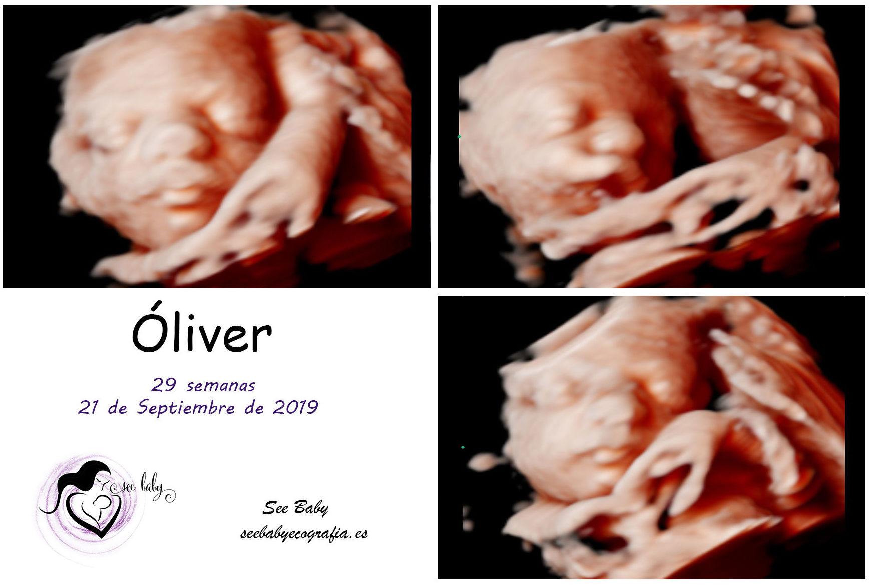 Querido Oliver - SeeBaby Ecografia 5D