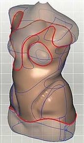 Tecnología 3D en ortopedia