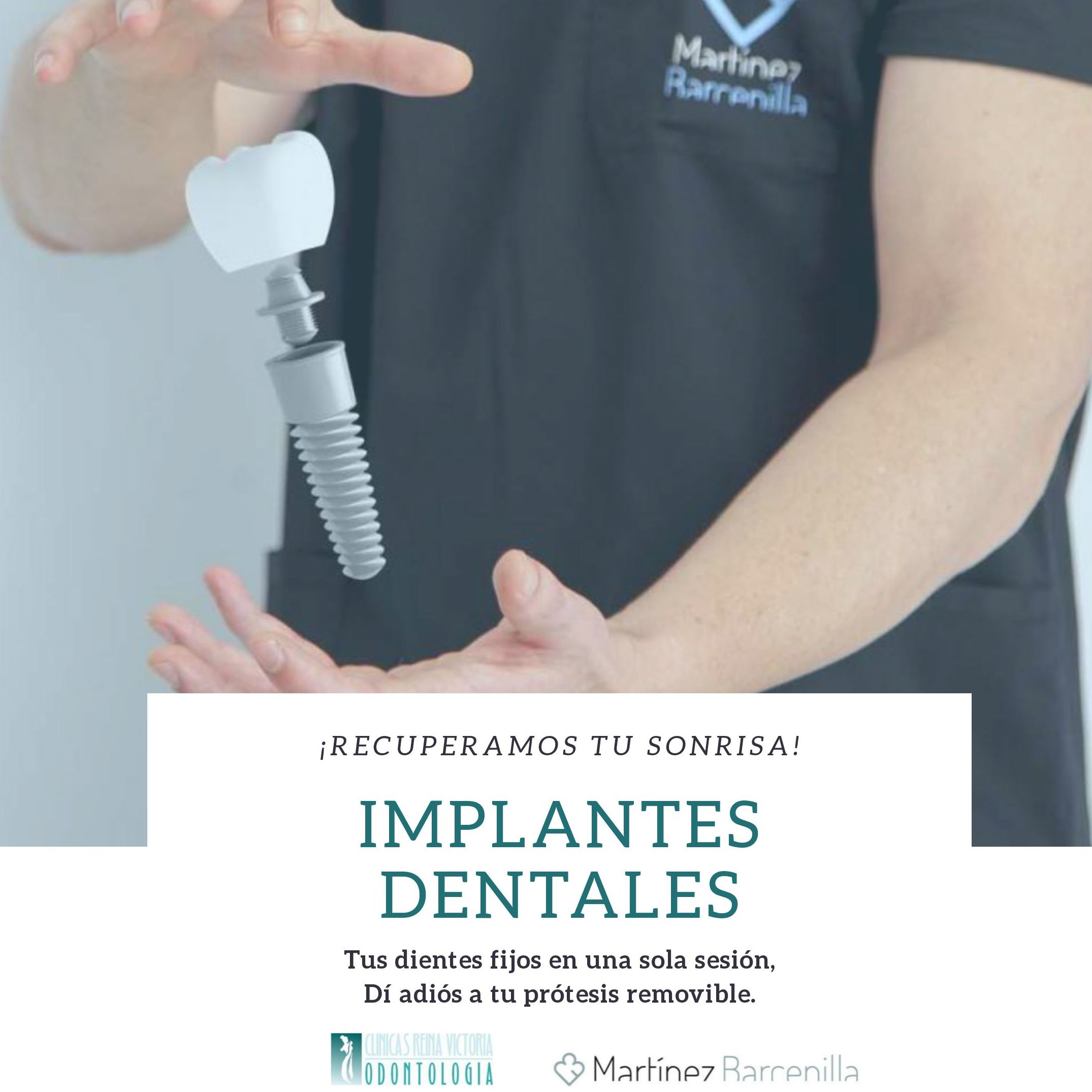 IMPLANTES DENTALES