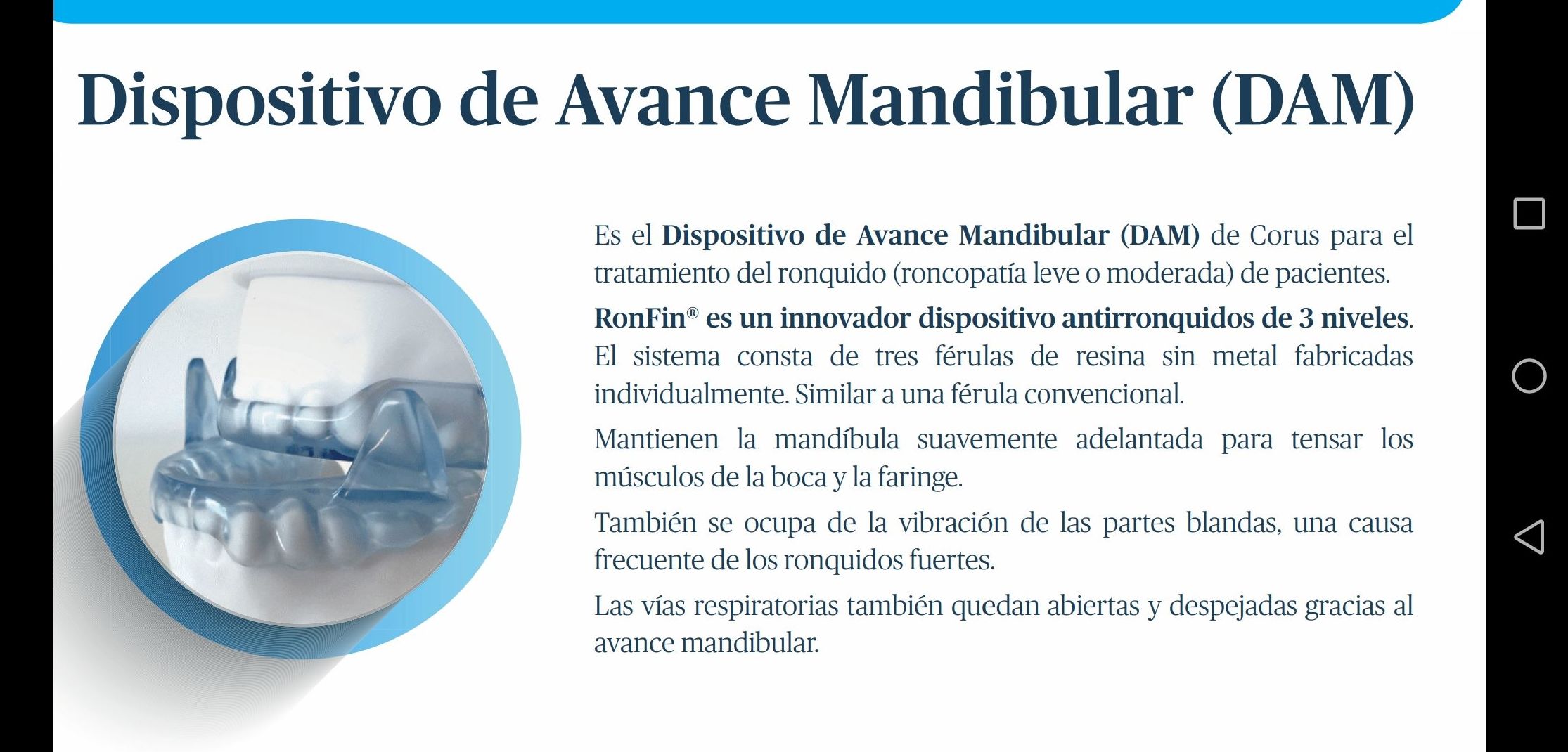 Apnea del sueño: tratamiento con férulas de avance mandibular