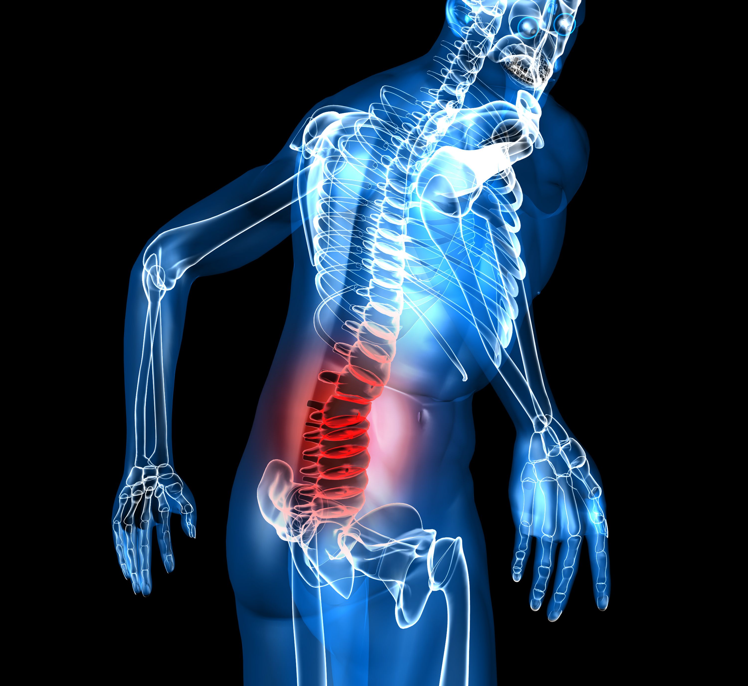 Tratamiento del dolor de columna