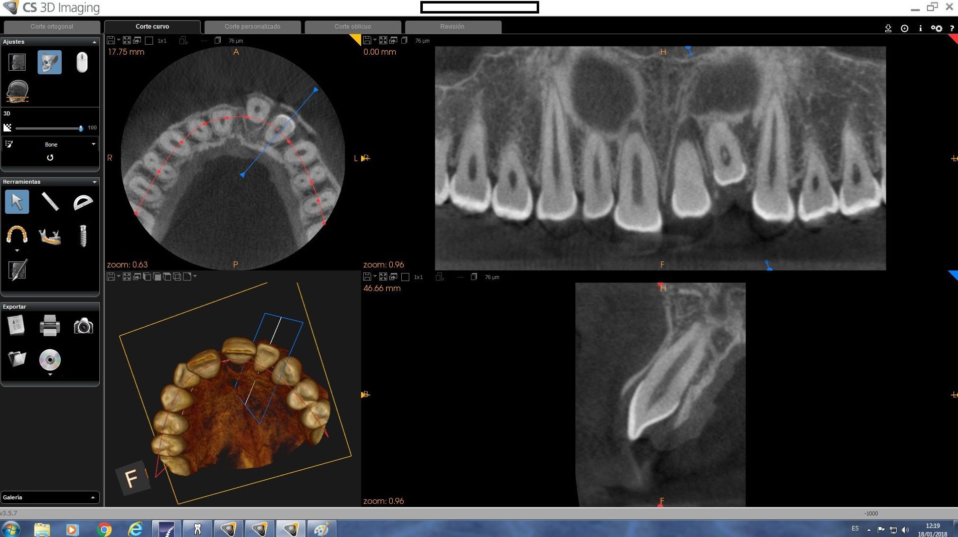 Radiología Tridimensional