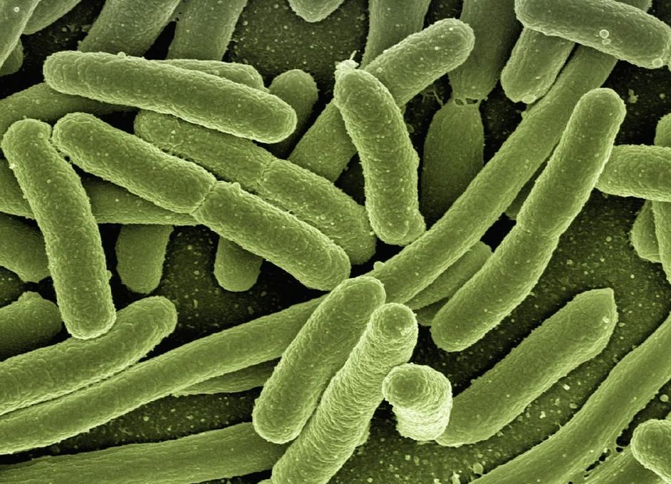 Legionella