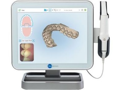 ESCÁNER INTRAORAL 3D