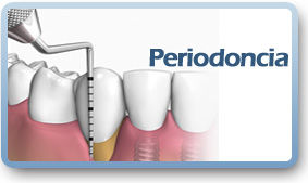 Periodoncia