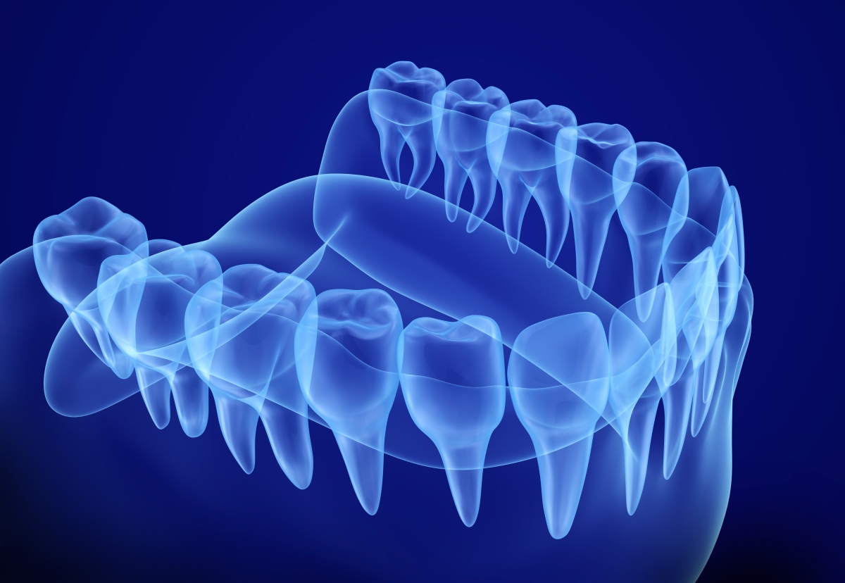 Escaneado de modelos dentales