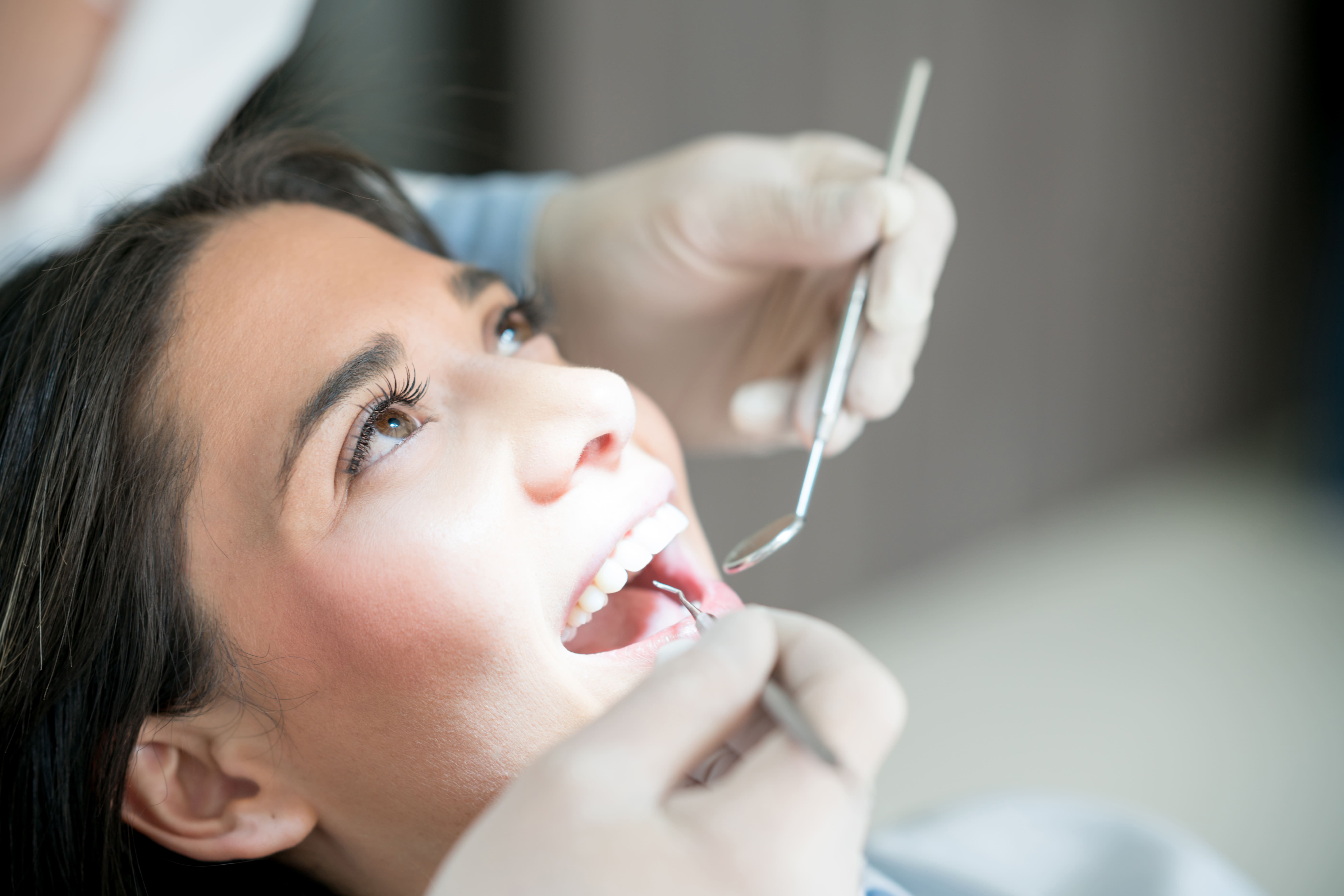 Implantes dentales