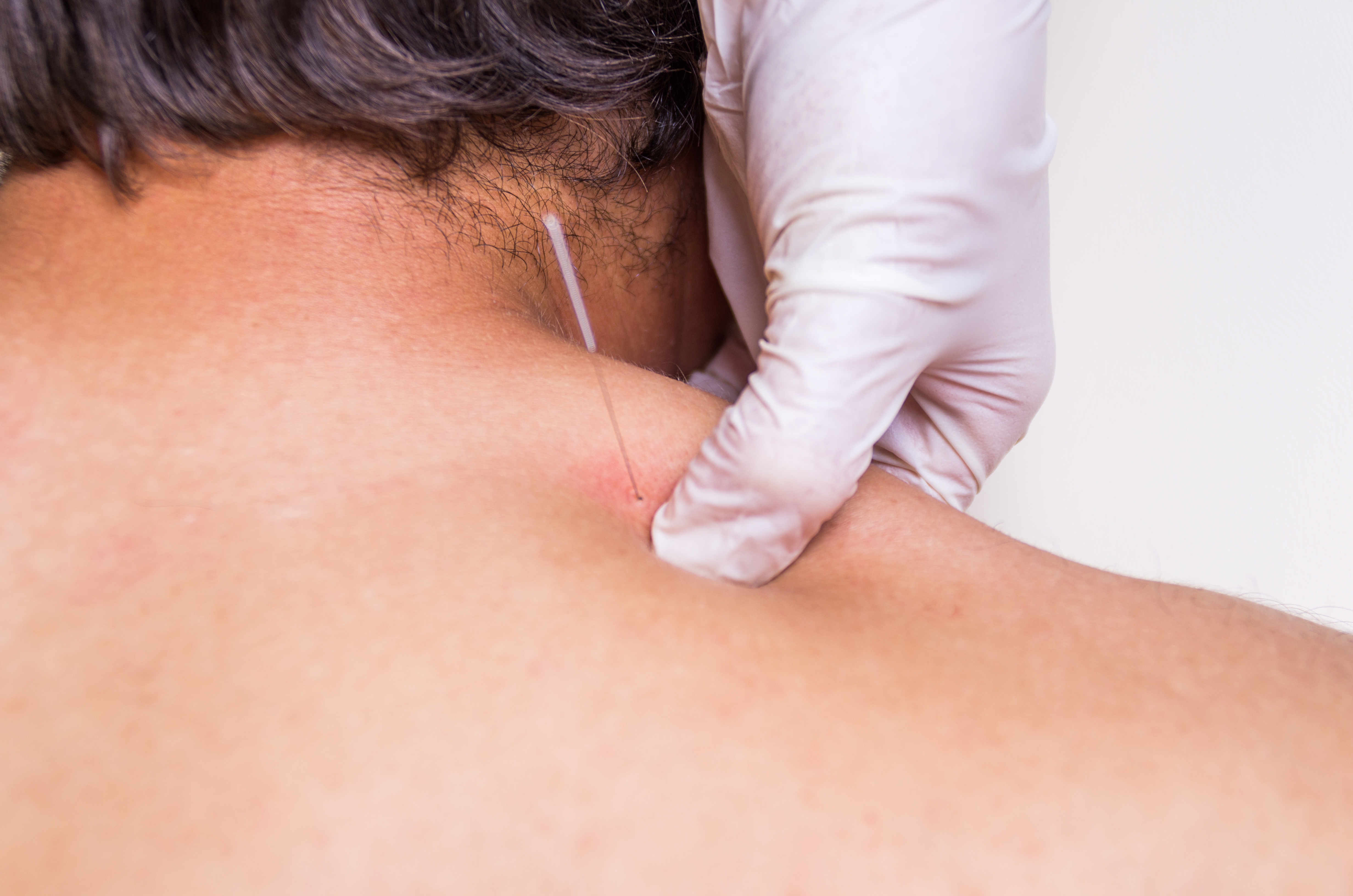 Fisioterapia invasiva ecoguiada
