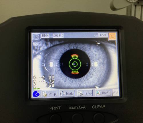 Lentes de contacto