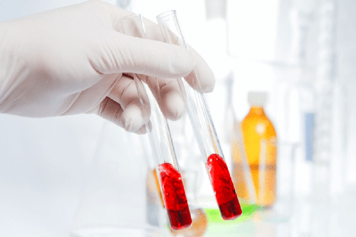 Plasma rico en plaquetas