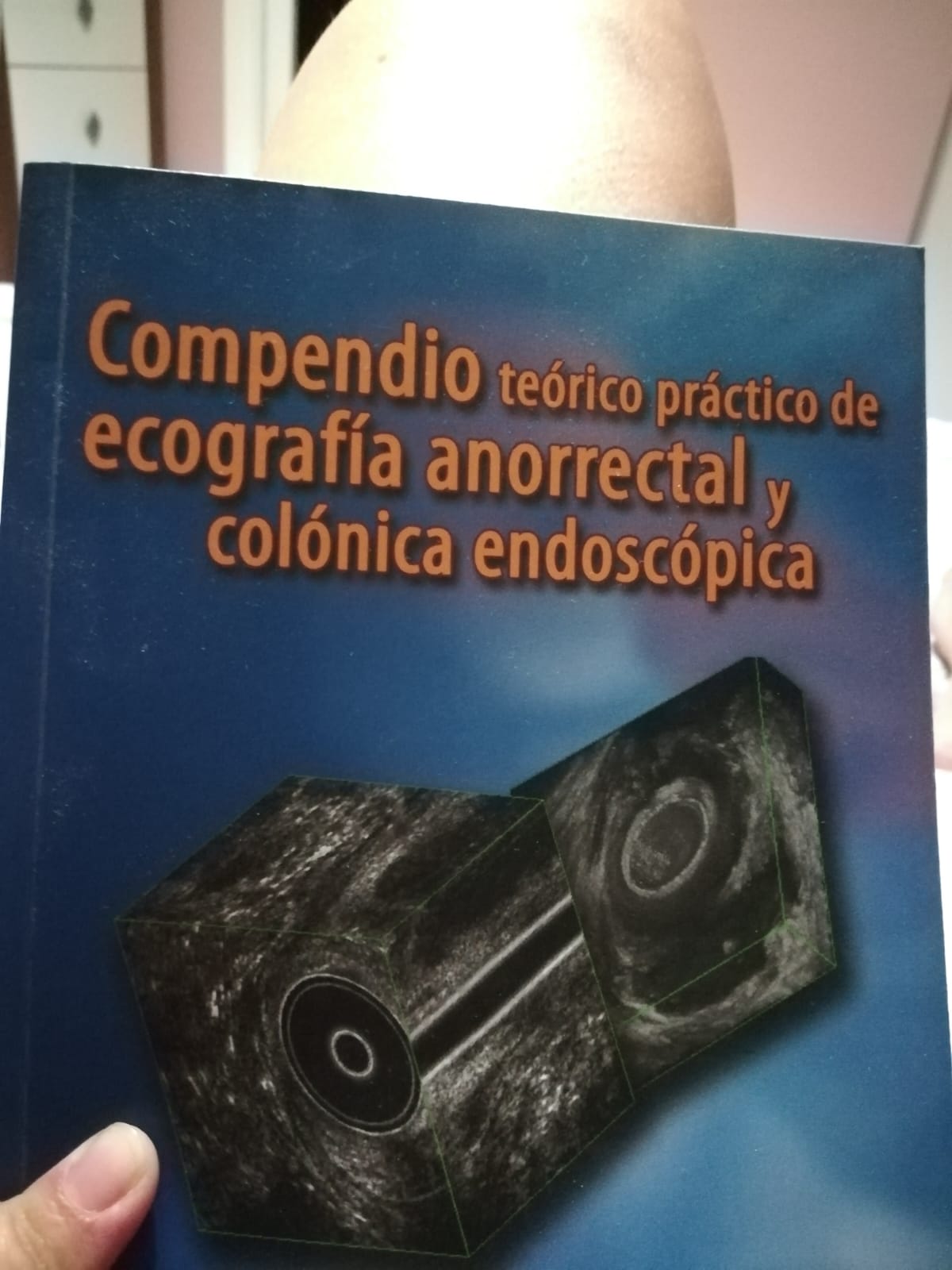 Condilomas