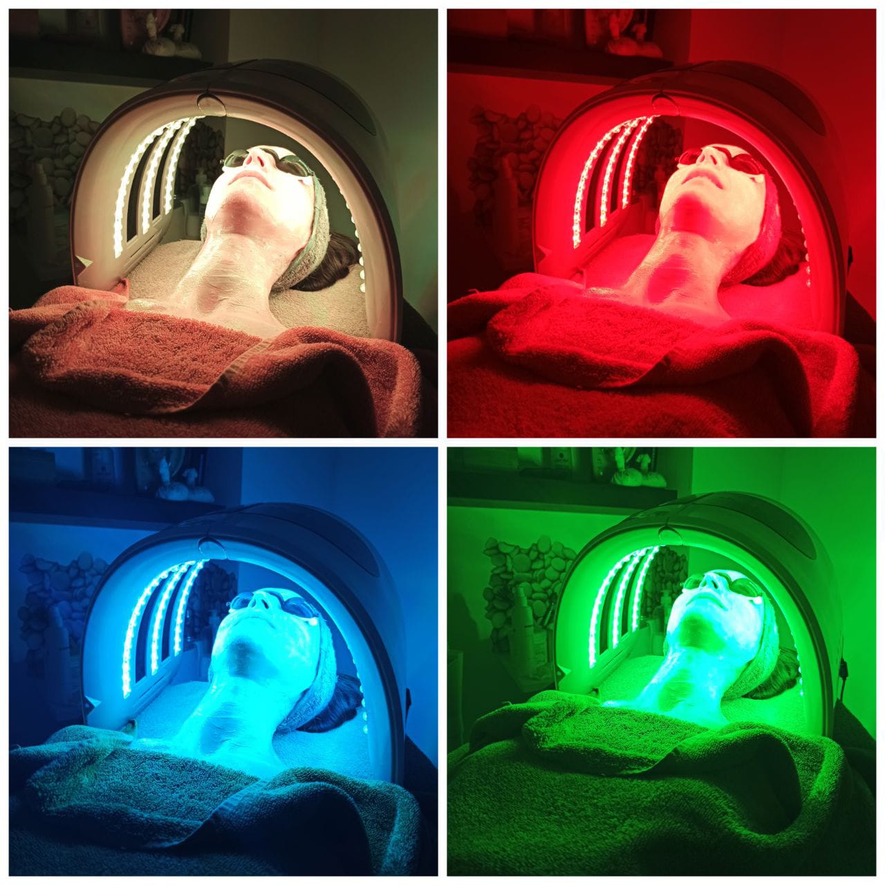 Técnicas de estética avanzada