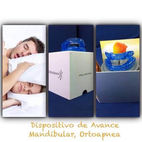 Dispositivo avance mandibular D.A.M Madrid, Hortaleza, Canillas.