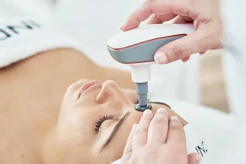 Radiofrecuencia Indiba facial