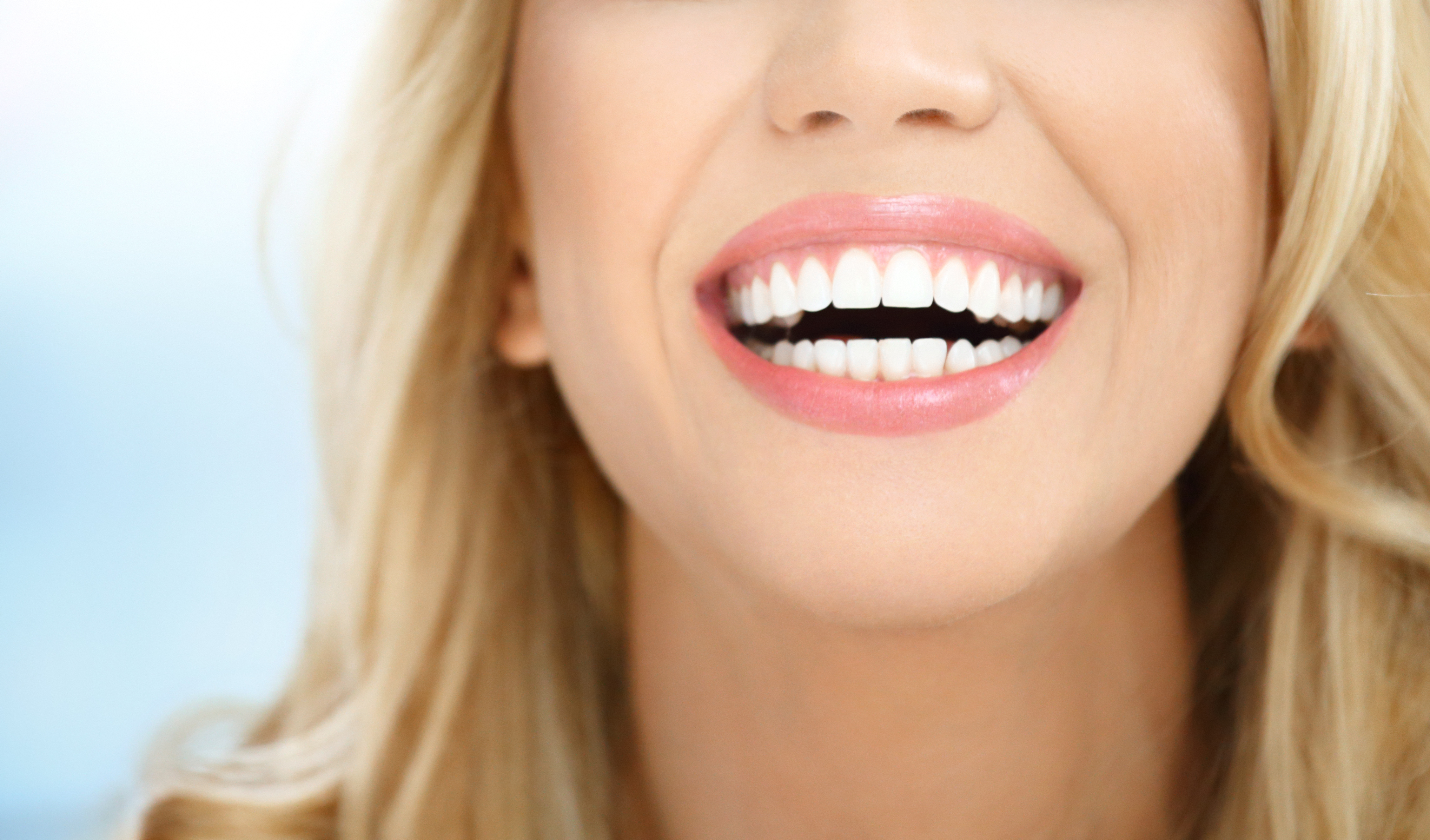 Carillas dentales