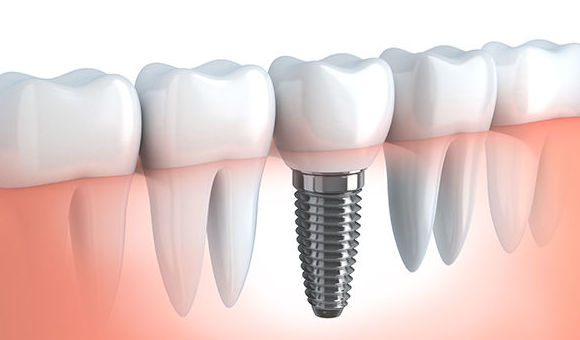 Clínica dental tres D