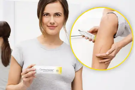 Contractubex Scar Removal Gel 20gm
