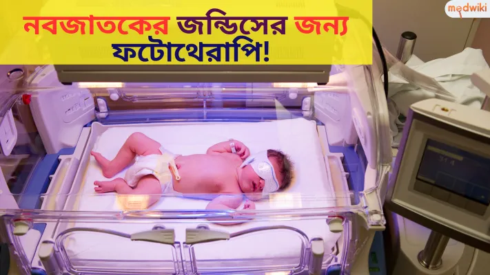 নবজাতকের জন্ডিসের জন্য ফটোথেরাপি!