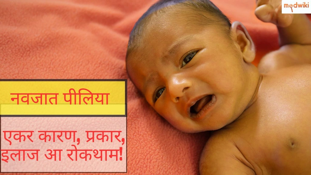 नवजात पीलिया : एकर कारण, प्रकार, इलाज आ रोकथाम!