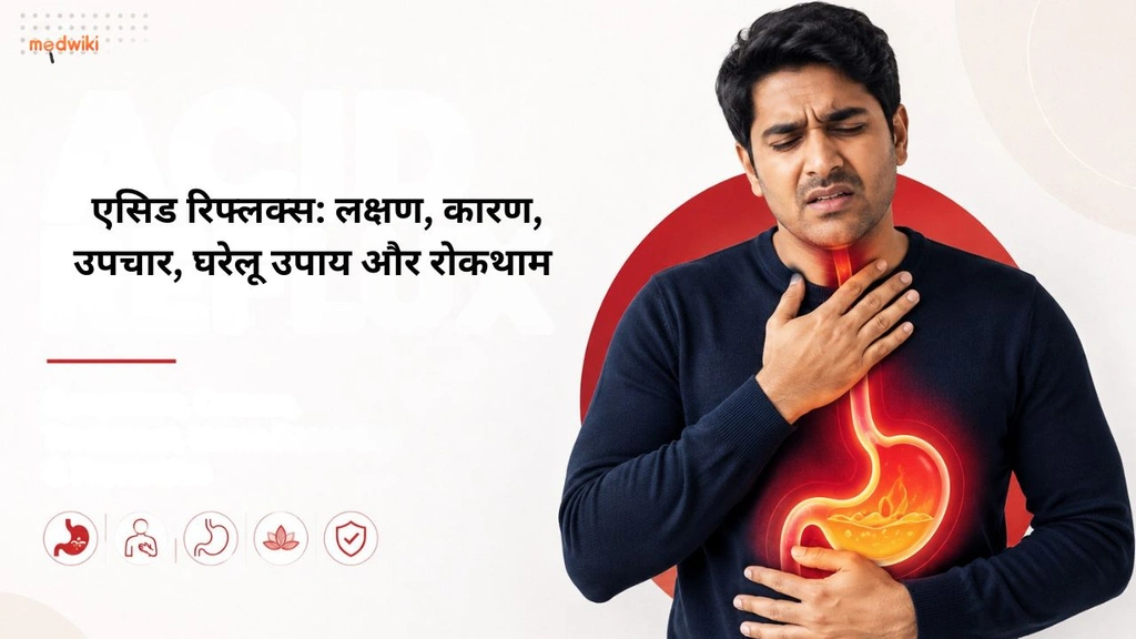 एसिड रिफ्लक्स: लक्षण, कारण, उपचार, घरेलू उपाय और रोकथाम (Acid reflux explained in Hindi)