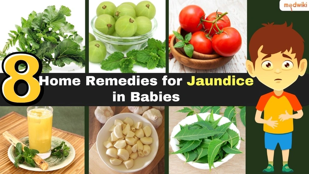 8 Home Remedies for Jaundice in Babies