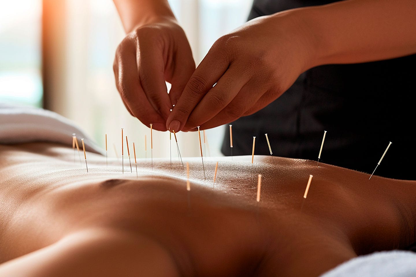 Massage & Akupunktur 70 Minuter 
