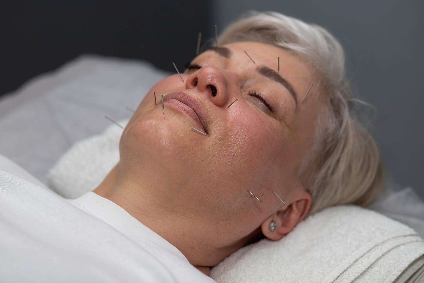 Massage & Akupunktur 70 Minuter 