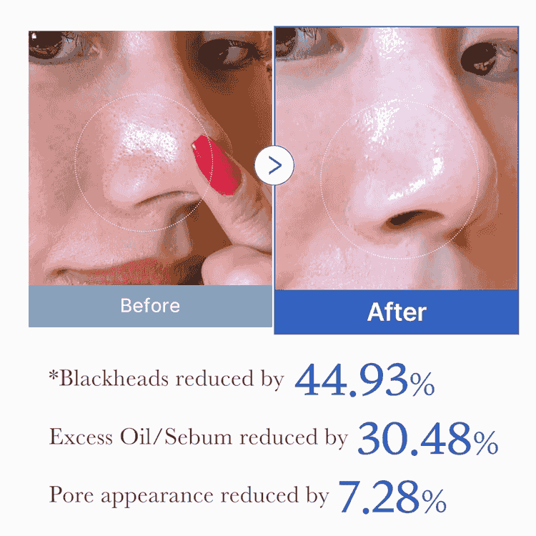 Medicube Zero Pore Pad 2.0 70 st