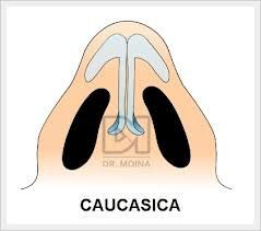 Caucasico