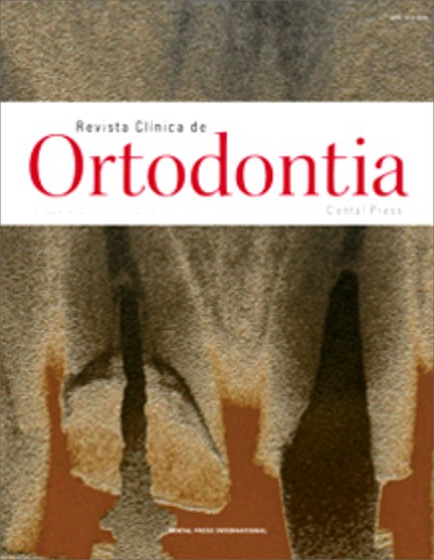 A técnica do arco reto em Ortodontia lingual com o uso do PW-MBP