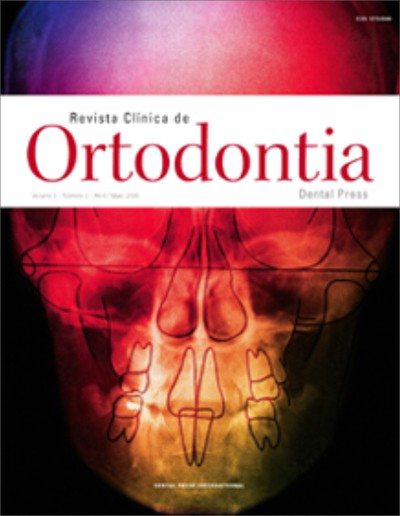 Ortodontia lingual: técnicas laboratoriais de montagem