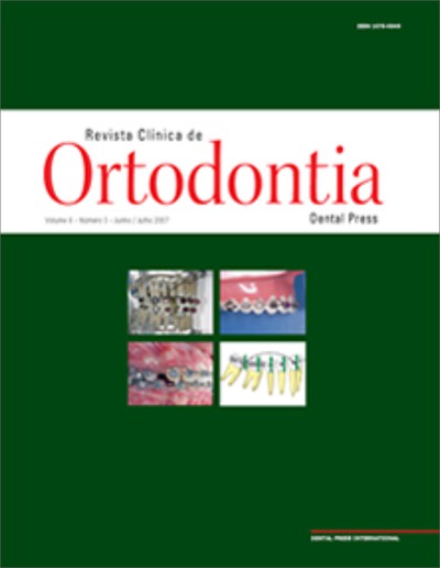 Corticotomias seletivas no osso alveolar para auxiliar a movimentação ortodôntica