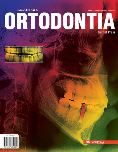 A eficácia da ortopedia pré-cirúrgica em pacientes com fissuras de lábio e palato: uma revisão sistemática da literatura