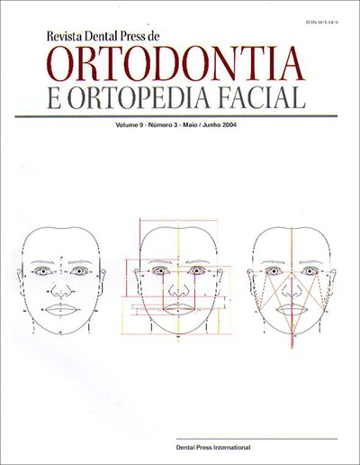 Estudo das dimensões transversais da face, em telerradiografias póstero-anteriores em indivíduos respiradores bucais com oclusão normal e má oclusão Classe I de Angle